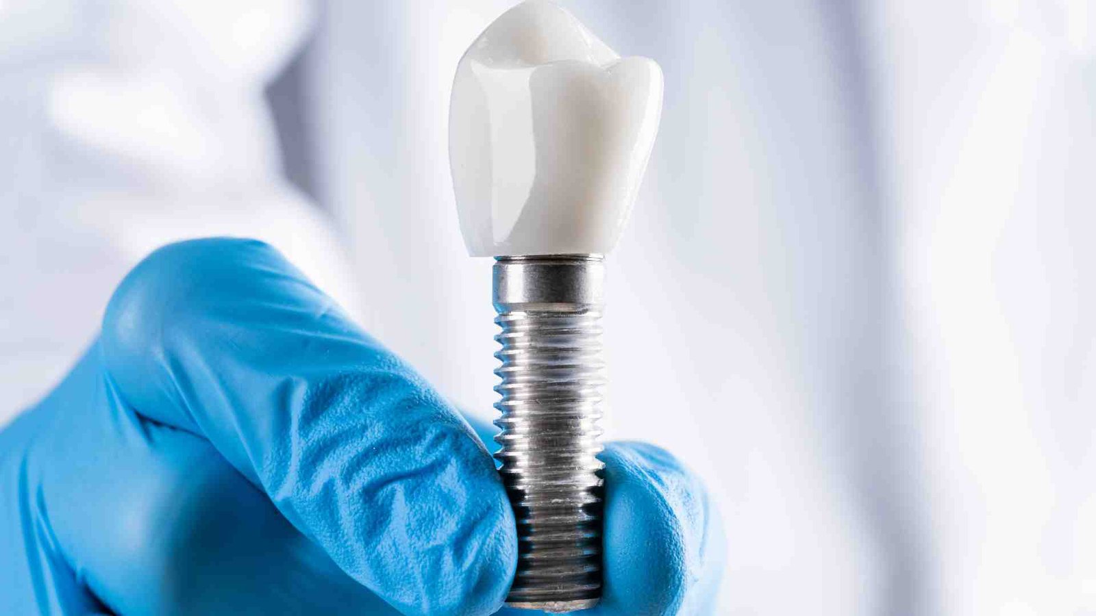 The Role of Technology in Dental Implants