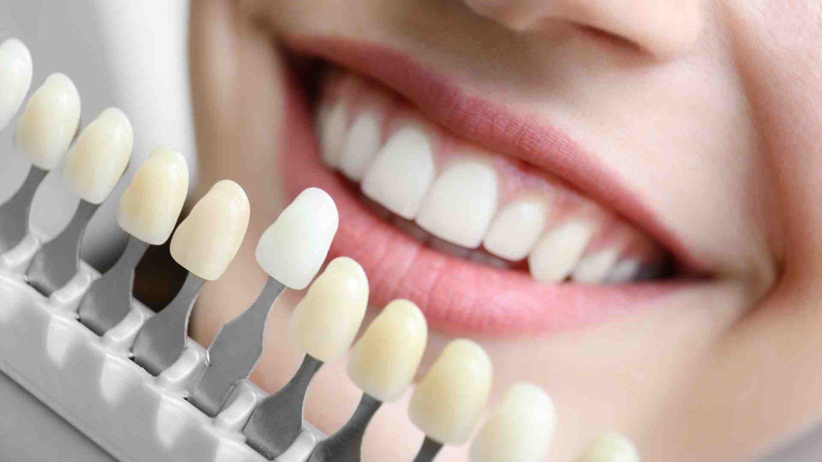 Is Teeth Whitening Safe?