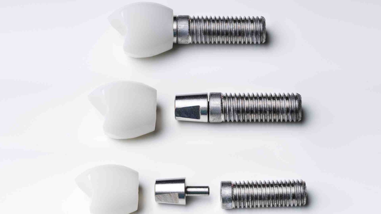 Why Dubai is a Leading Destination for Dental Implants